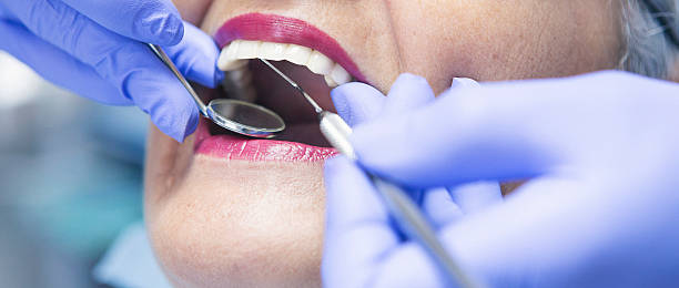 Teeth Whitening in MA
